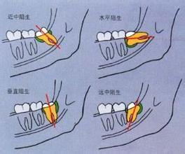 下載 (2).jpg