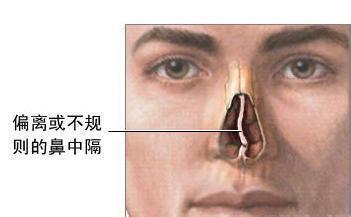 u=2746906669,3003178666&fm=23&gp=0.jpg